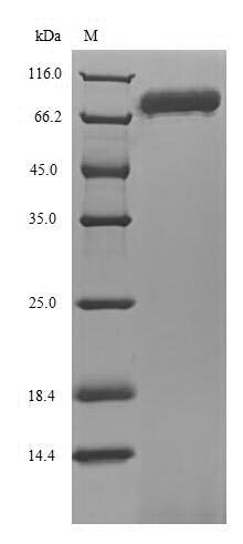 Human Ecto-NOX disulfide-thiol exchanger 1 (ENOX1) Recombinant Protein, N-His, Homo sapiens (Human), E.coli, N-terminal 6xHis-tagged, 77.3 kDa, purity >≥ 85% as determined by SDS-PAGE.
