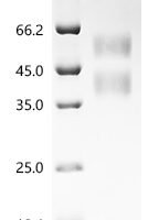 Human Transforming growth factor beta-1 proprotein (TGFB1) Recombinant Protein, N-His - BioCrest Sci