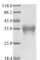 Pongo abelii Lysosome-associated membrane glycoprotein 5 (LAMP5), partial Recombinant Protein, N-10His/C-Myc - BioCrest Sci