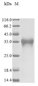 Pongo abelii Lysosome-associated membrane glycoprotein 5 (LAMP5), partial Recombinant Protein, N-10His/C-Myc, Pongo abelii (Sumatran orangutan), Mammalian cell, N-terminal 10xHis-tagged and C-terminal Myc-tagged, 28 kDa, purity >≥ 90% as determined by SDS-PAGE.