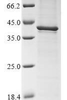 Murine polyomavirus Major capsid protein VP1 Recombinant Protein, C-His - BioCrest Sci