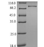 Human ATP synthase F(1) complex subunit alpha, mitochondrial (ATP5F1A) Recombinant Protein, N-His-SUMO - BioCrest Sci