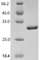 Human Alpha-ketoglutarate-dependent dioxygenase alkB homolog 3 (ALKBH3) Recombinant Protein, C-His - BioCrest Sci