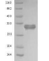 Human Pyridoxal phosphate phosphatase (PDXP) Recombinant Protein, N-His - BioCrest Sci