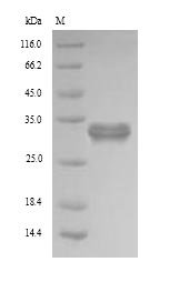 Human Pyridoxal phosphate phosphatase (PDXP) Recombinant Protein, N-His, Homo sapiens (Human), Yeast, N-terminal 6xHis-tagged, 33.7 kDa, purity >≥ 90% as determined by SDS-PAGE.