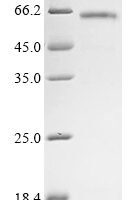Dog Catalase (CAT), partial Recombinant Protein - BioCrest Sci