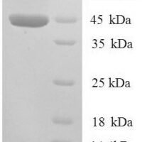 Human All-trans-retinol dehydrogenase [NAD (+)] ADH7 (ADH7) Recombinant Protein, N-His, aa 1–386, E.coli - BioCrest Sci