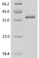Human Agouti-signaling protein (ASIP) Recombinant Protein, N-His-SUMO - BioCrest Sci