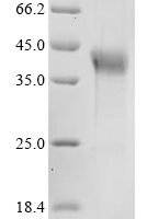 Mouse Haptoglobin (Hp) Recombinant Protein - BioCrest Sci
