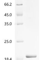 Escherichia coli O6:K15:H31 Lipid A palmitoyltransferase PagP (pagP) Recombinant Protein - BioCrest Sci