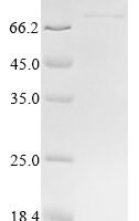 Human Repulsive guidance molecule A (RGMA) Recombinant Protein - BioCrest Sci