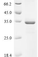 Human 28S ribosomal protein S21, mitochondrial (MRPS21) Recombinant Protein, N-GST, aa 1–87, E.coli - BioCrest Sci