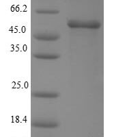 Human Estrogen receptor beta (ESR2) Recombinant Protein, N-His-SUMO - BioCrest Sci
