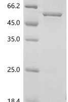 Human Sodium/potassium-transporting ATPase subunit alpha-1 (ATP1A1), partial Recombinant Protein, N-10His/C-Myc - BioCrest Sci