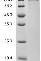 Human Transcription factor 4 (TCF4), Biotinylated Recombinant Protein - BioCrest Sci