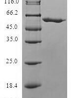 Human Mitochondrial carnitine/acylcarnitine carrier protein (SLC25A20) Recombinant Protein - BioCrest Sci