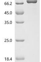Human Clarin-1 (CLRN1), partial Recombinant Protein - BioCrest Sci