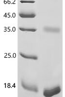 Human Proton-coupled zinc antiporter SLC30A1 (SLC30A1), partial Recombinant Protein, N-His/C-His - BioCrest Sci