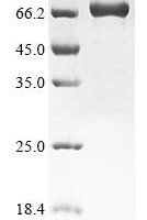 Human Insulin-like growth factor 2 mRNA-binding protein 3 (IGF2BP3) Recombinant Protein - BioCrest Sci