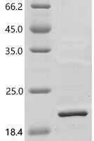 Human Glycolipid transfer protein domain-containing protein 2 (GLTPD2), partial Recombinant Protein - BioCrest Sci