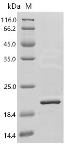 Human Glycolipid transfer protein domain-containing protein 2 (GLTPD2), partial Recombinant Protein, E.coli, C-terminal 6xHis-tagged, 15.5 kDa, purity >≥ 85% as determined by SDS-PAGE.