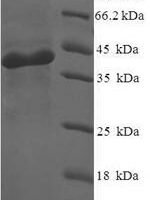 Human Nicotinamide mononucleotide adenylyltransferase 3 (NMNAT3) Recombinant Protein - BioCrest Sci