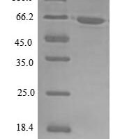 Human ATP-dependent RNA helicase A (DHX9), partial Recombinant Protein, N-10His - BioCrest Sci