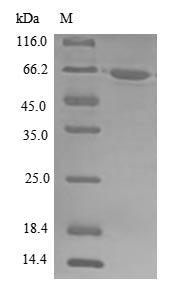 Human ATP-dependent RNA helicase A (DHX9), partial Recombinant Protein, N-10His, Homo sapiens (Human), E.coli, N-terminal 10xHis-tagged, 62.1 kDa, purity >≥ 85% as determined by SDS-PAGE.