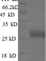 Rat Vascular endothelial growth factor A (Vegfa) Recombinant Protein - BioCrest Sci