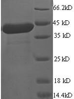 Human Programmed cell death protein 6 (PDCD6) Recombinant Protein - BioCrest Sci