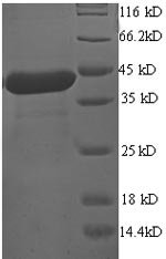 Human Programmed cell death protein 6 (PDCD6) Recombinant Protein, Homo sapiens (Human), E.coli, N-terminal GST-tagged, 49.3 kDa, purity >≥ 90% as determined by SDS-PAGE.