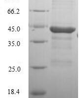 Human Dihydroorotate dehydrogenase (quinone), mitochondrial (DHODH), partial Recombinant Protein, N-His - BioCrest Sci