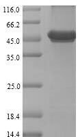 Renilla reniformis Coelenterazine h 2-monooxygenase Recombinant Protein - BioCrest Sci