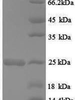 Rat GTPase HRas (Hras) Recombinant Protein - BioCrest Sci