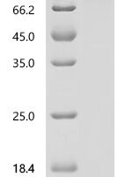 Macaca fascicularis ITGAV&ITGB6 Heterodimer Protein, Biotinylated Recombinant Protein - BioCrest Sci