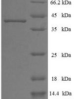 Epstein-Barr virus DNA polymerase catalytic subunit (BALF5), partial Recombinant Protein - BioCrest Sci