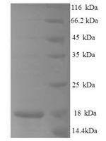 Mouse C-C motif chemokine 25 (Ccl25), partial Recombinant Protein - BioCrest Sci