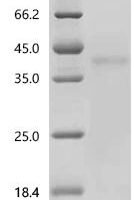 Human Tumor Calcium-binding protein 39 CAB39) Recombinant Protein - BioCrest Sci