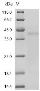 Human Tumor Calcium-binding protein 39 CAB39) Recombinant Protein, Homo sapiens (Human), Homo sapiens (Human), N-terminal 6xHis-tagged and C-terminal GFP-tagged, 67.8 kDa, purity >≥ 95% as determined by SDS-PAGE.
