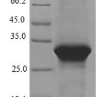 Human Lipolysis-stimulated lipoprotein receptor (LSR), partial Recombinant Protein - BioCrest Sci