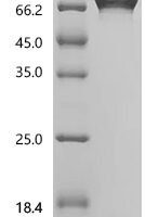 Macaca fascicularis Interleukin-2 receptor subunit alpha (IL2RA), partial Recombinant Protein - BioCrest Sci