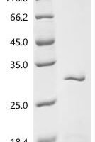 Sulfolobus solfataricus Reverse gyrase 1 (rgy1), partial Recombinant Protein - BioCrest Sci