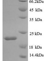 Mouse Interleukin-18-binding protein (Il18bp) Recombinant Protein - BioCrest Sci