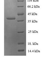 Human 60S ribosomal protein L30 (RPL30) Recombinant Protein - BioCrest Sci