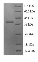 Human 60S ribosomal protein L30 (RPL30) Recombinant Protein, Homo sapiens (Human), E.coli, N-terminal GST-tagged, 39.8 kDa, purity >≥ 90% as determined by SDS-PAGE.