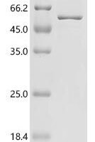 Zea mays Transcription factor TEOSINTE BRANCHED 1 (TB1) Recombinant Protein, C-His, aa 1–376, E.coli - BioCrest Sci