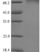 Human Histone-lysine N-methyltransferase NSD3 (NSD3) Recombinant Protein - BioCrest Sci