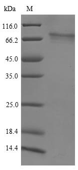 Human Histone-lysine N-methyltransferase NSD3 (NSD3) Recombinant Protein, Homo sapiens (Human), Yeast, N-terminal 6xHis-tagged, 73.9 kDa, purity >≥ 85% as determined by SDS-PAGE.