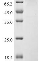Rat Mannan-binding lectin serine protease 2 (Masp2) Recombinant Protein, C-His - BioCrest Sci