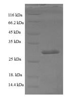 Human Activated RNA polymerase II transcriptional coactivator p15 (SUB1) Recombinant Protein - BioCrest Sci